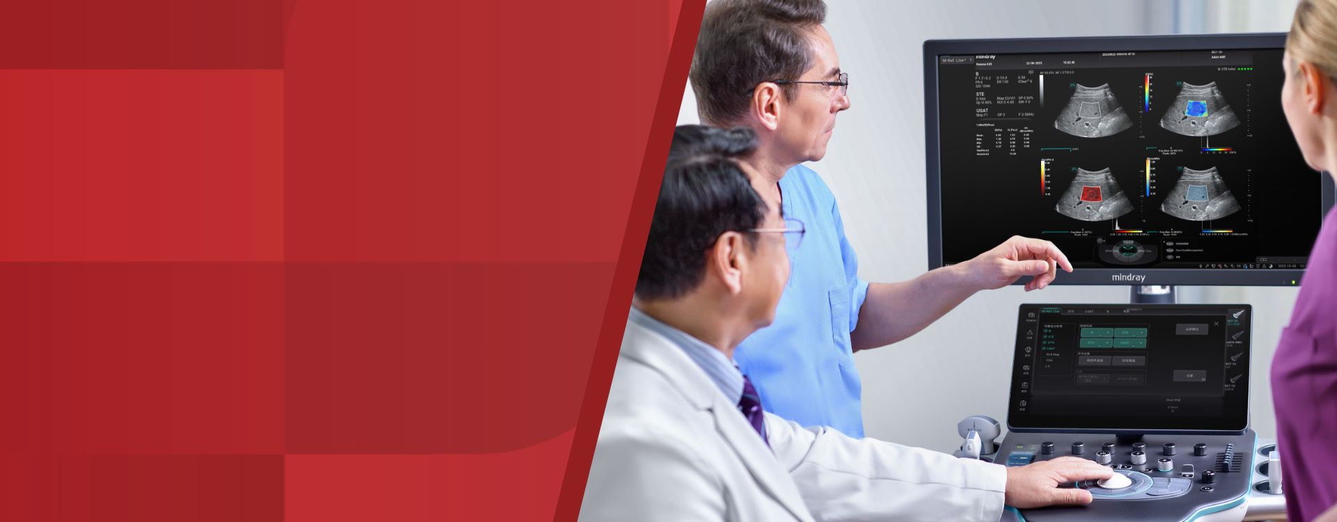 Mindray Ultrasound Systems